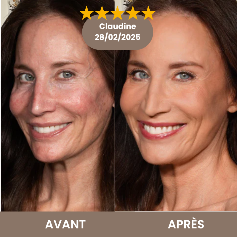 Avant Après Claudine