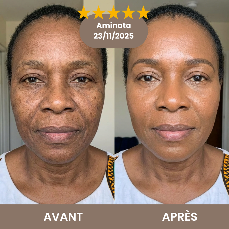 Avant Après Aminata